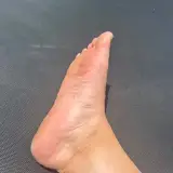 Trampoline · 3 — DroitVoûte96